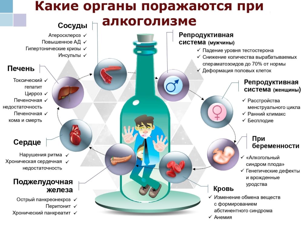 Инфографика о вред употребления алкоголя 